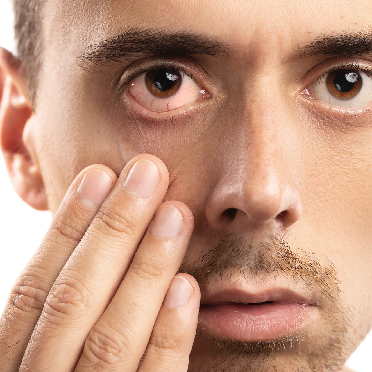 CSI Dry Eye Software